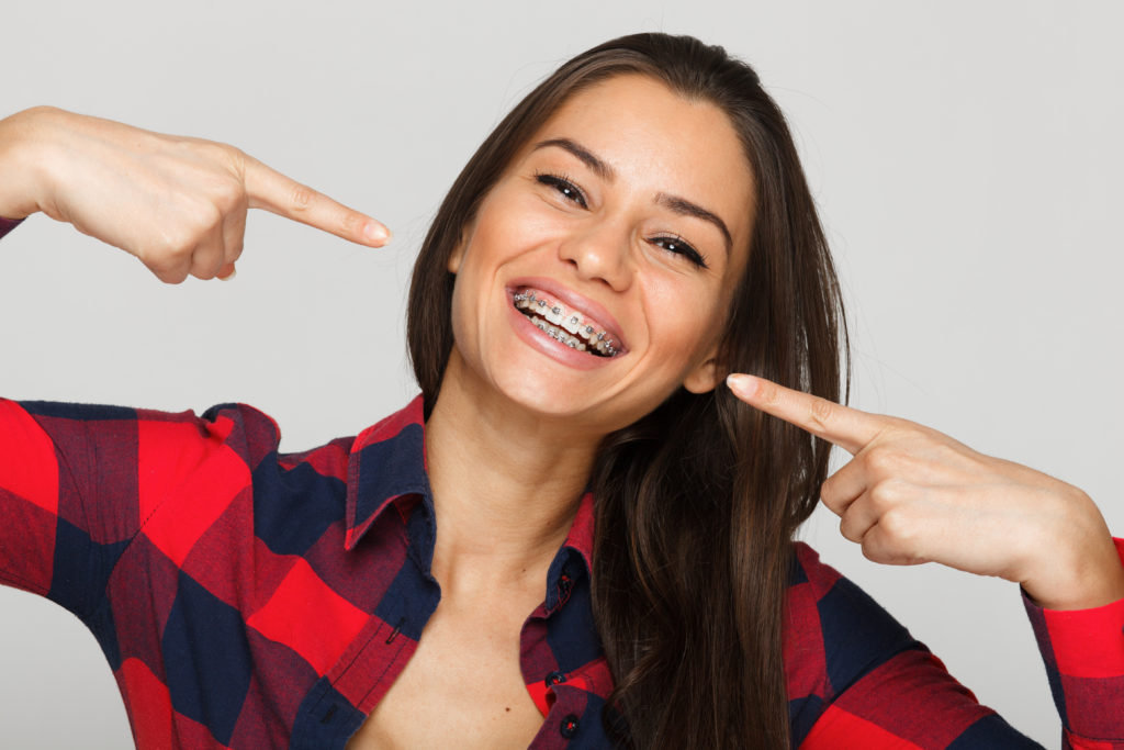 Woman pointing to her smile with braces on her teeth